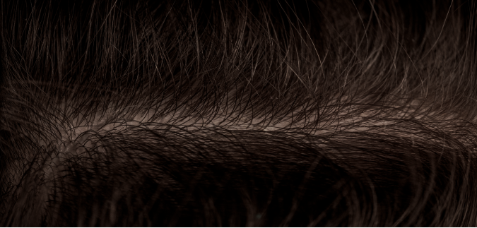 After — even, natural tone